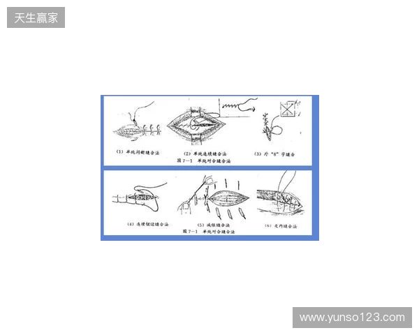 广州豹官方：杨浩眉弓伤口缝合30余针，预计5-7天后拆线